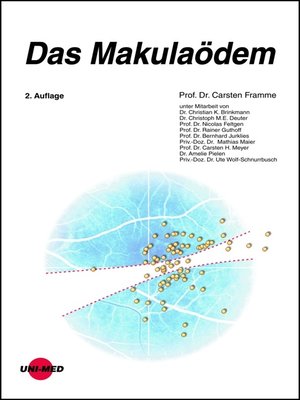 cover image of Das Makulaödem